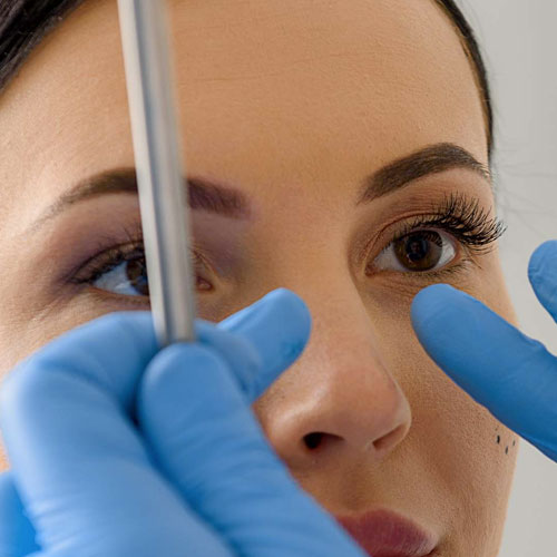 rinoplastia-procedimiento-1 cirugía de nariz