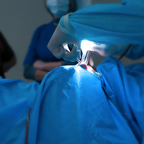 rinoplastia-procedimiento-2 rinoplastia en cdmx
