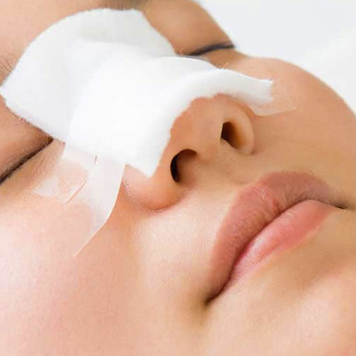 rinoplastia-procedimiento-3 cirugía de nariz post-operatorio