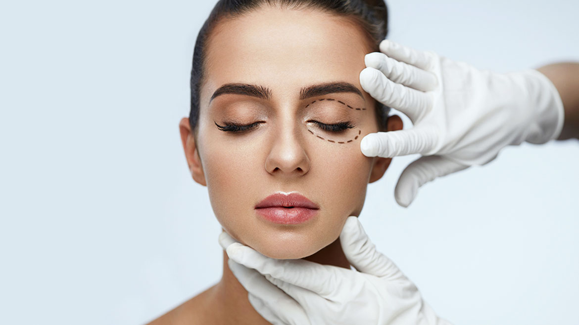 Blefaroplastia