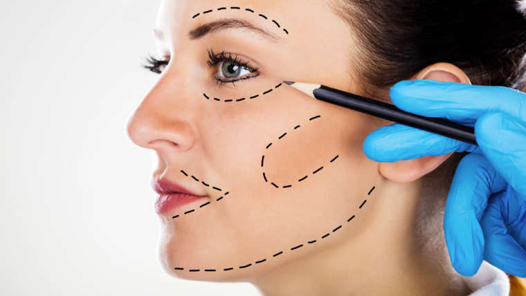 Lifting Facial